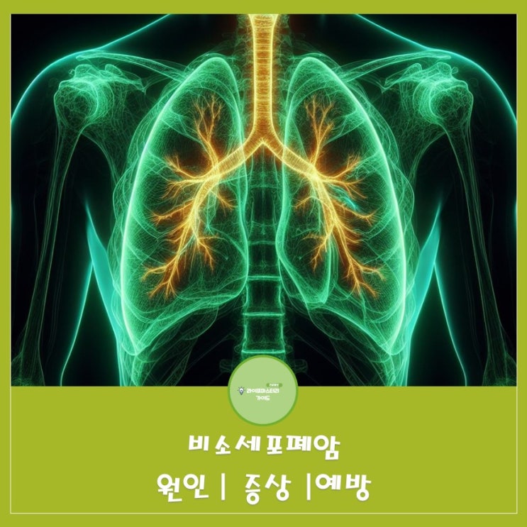  전체 폐암 환자의 약 85%를 차지하는 비소세포폐암 원인|증상|예방