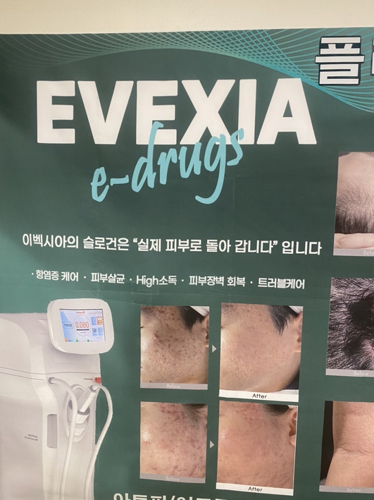  부산 남자 여드름 피부관리 추천 나는네가예쁘다