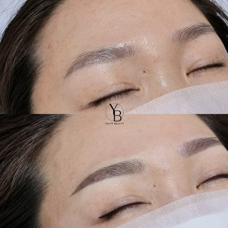  광주 서구 쌍촌동 눈썹문신 잔흔 때문에 고민이었는데..