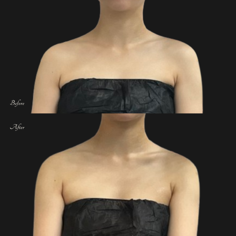 울산다이어트, 통증관리 체형교정까지 동시에 가능했던 하이퍼소닉 어나더제이뷰티 울산 본....