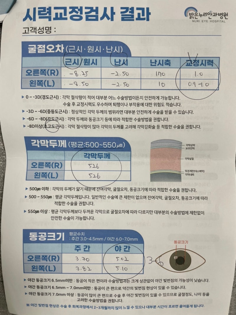 대전 스마일라식 밝은누리안과 초고도근시 난시 수술 성공 후기