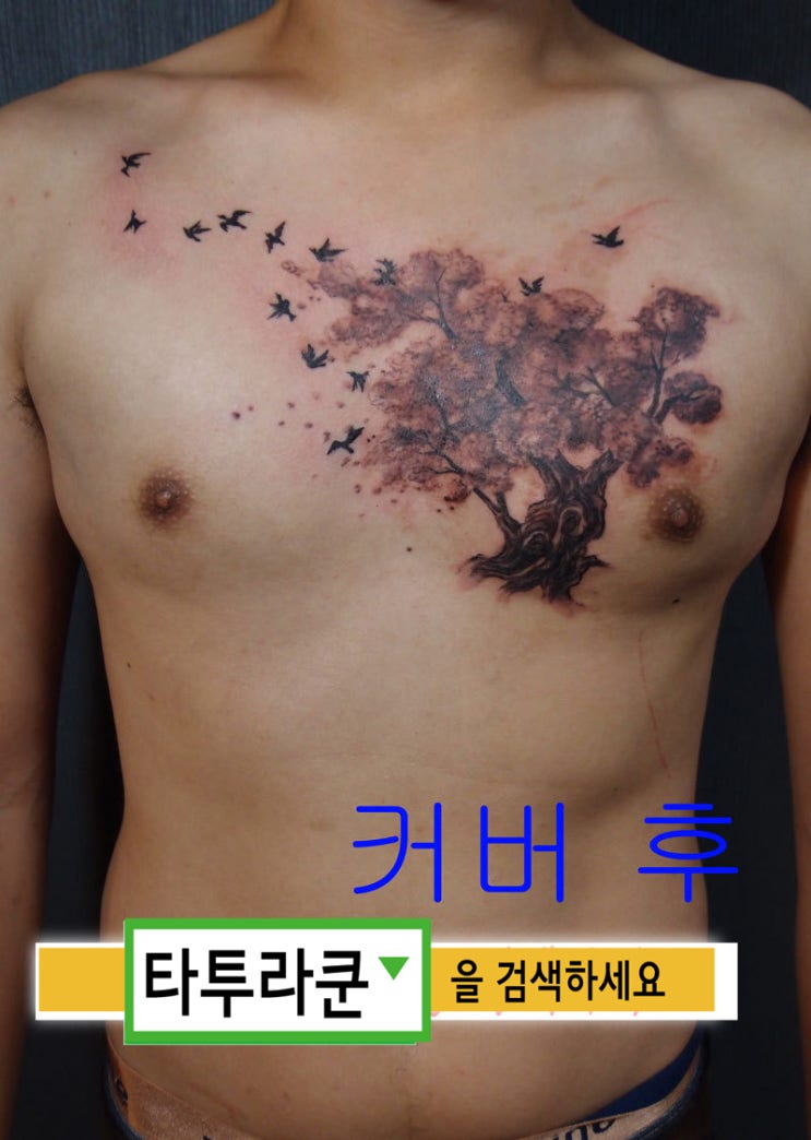  반점 커버업타투/나무타투/남자가슴문신[홍대타투라쿤]