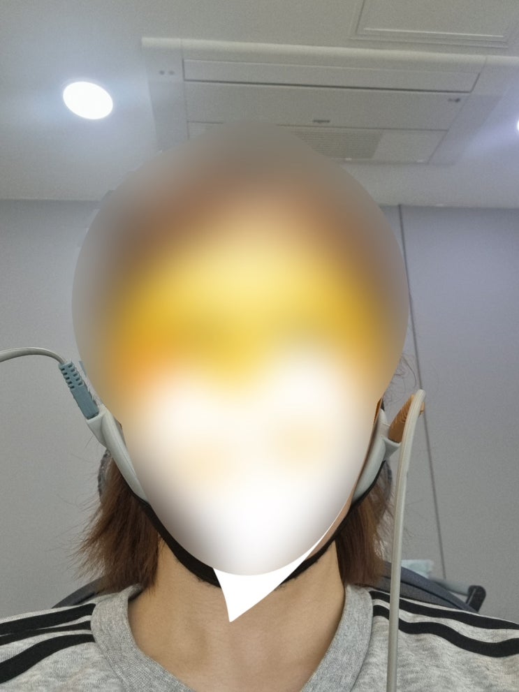  나의 턱관절 95% 완치일지 -2 (스플린트, 물리치료, 비용)