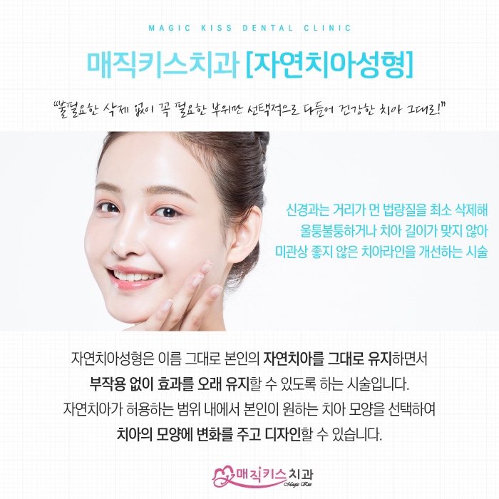  치아성형의 종류와 각각의 특징