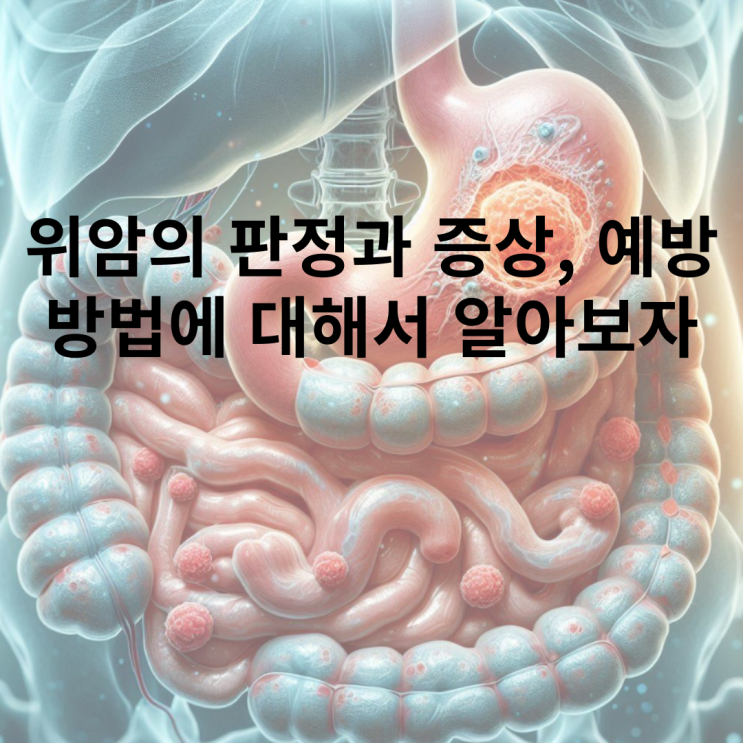  위암 판정과 종류에 대해서 파헤치자!