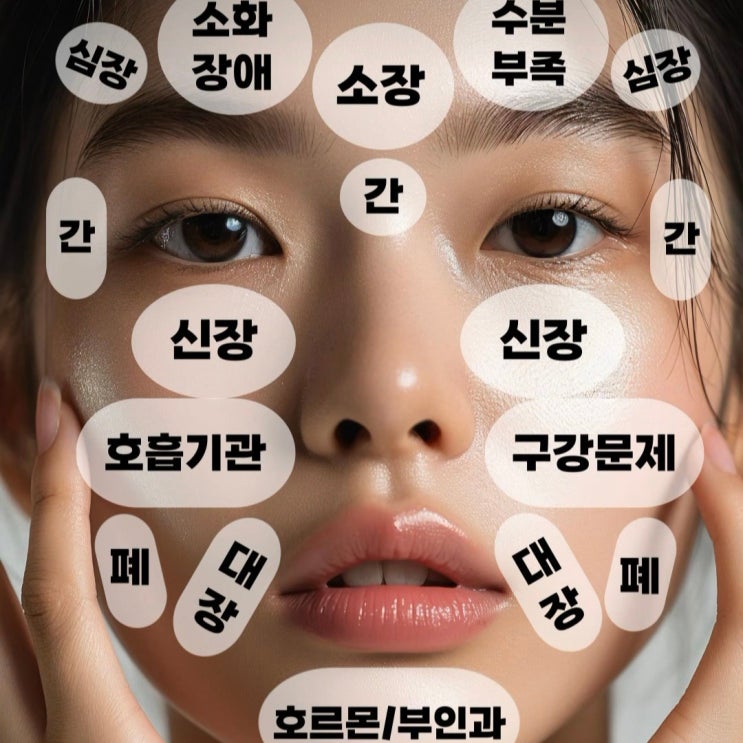  여드름 부위별 원인 이마,볼,관자놀이,코,인중 여드름 원인 없애는법