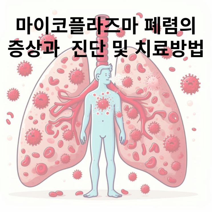  마이코플라즈마 폐렴의 초기증상에 대해 알아보자