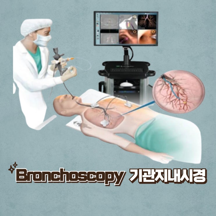 기관지내시경(bronchoscopy) 검사란? 목적과 합병증, 기관지내시경 간호