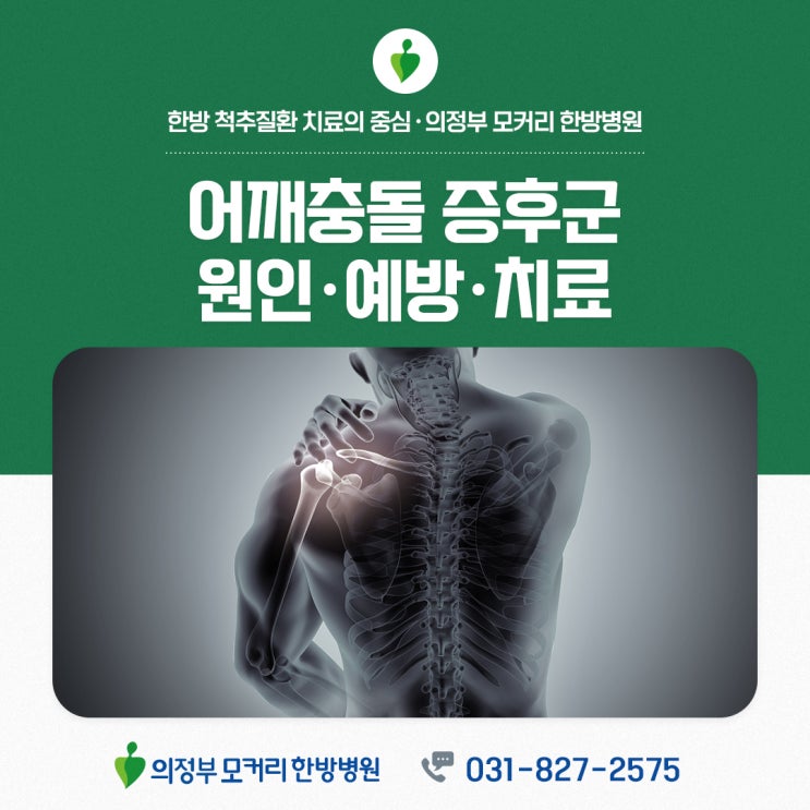  의정부 어깨통증 모커리 한방병원 추천, 어깨충돌증후군 예방하려면