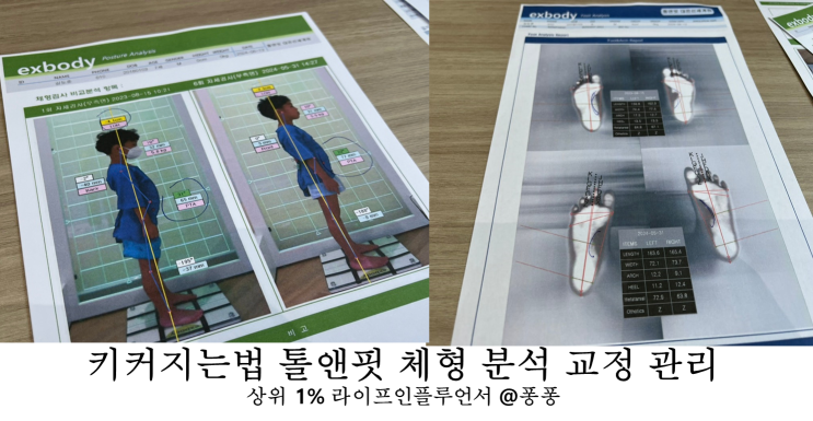 키커지는법 대전 세종 성장클리닉 톨앤핏 체형 분석 교정 관리 키유전 극복