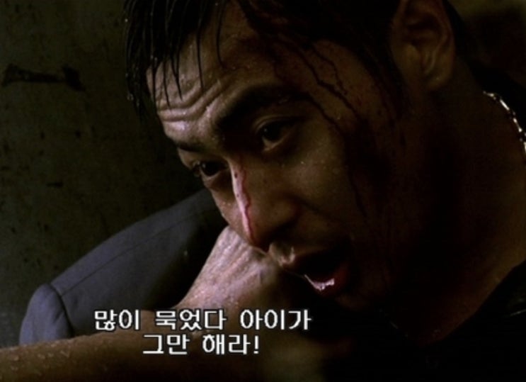  보건복지부 박민수 차관 “전화할 수 있으면, 찢어져 피 많이 나도 경증”