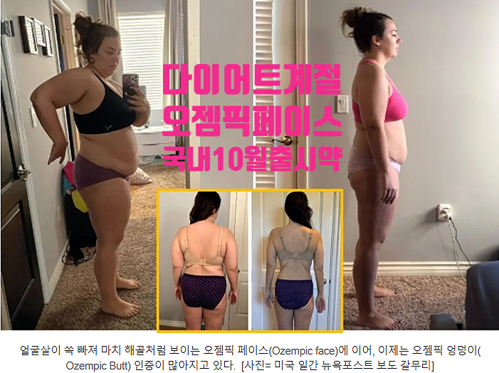  개전開戰: 가을, 거대한 전쟁의 서막이 열린다 (#오젬픽페이스 #오젬픽바디)건강,헬스케어 산업의 게임체인저 당뇨/비만치료제,노보 노디스크 국내 위고비 10월 출시