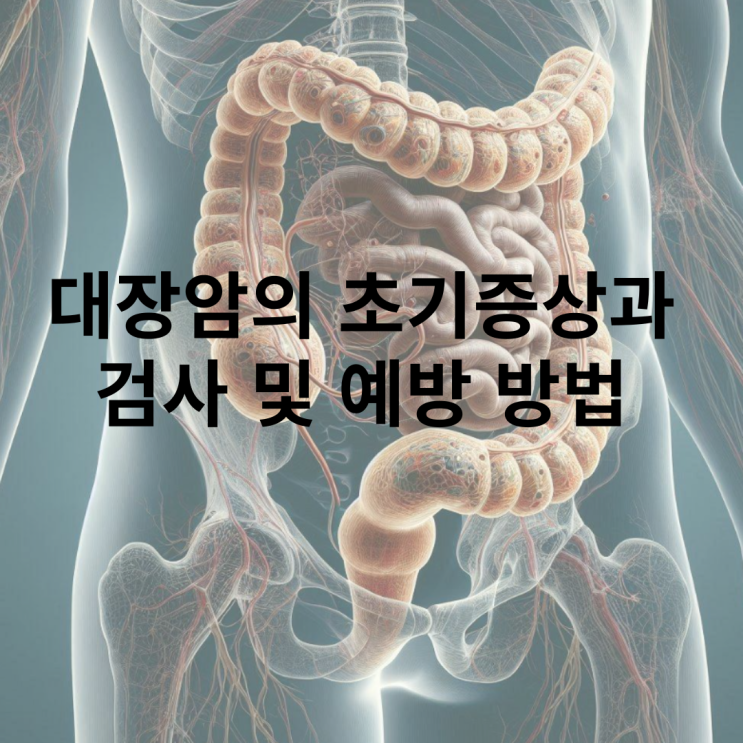  대장암 초기 증상은 무엇일까?