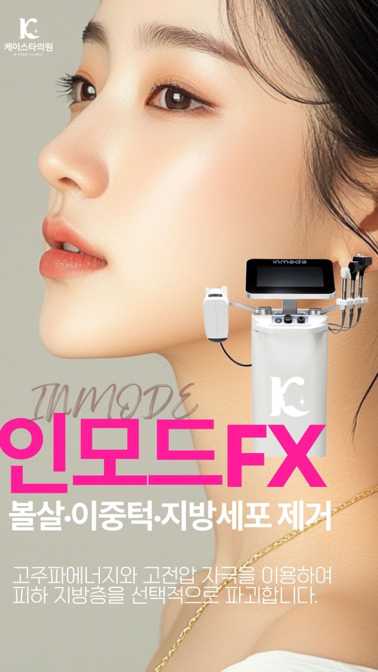  수완지구인모드 후기가 알려주는 FX 광주에서 잘하는곳은