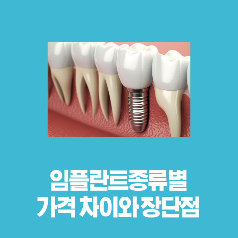 임플란트종류 가격 차이와 장단점 한눈에 비교해보기