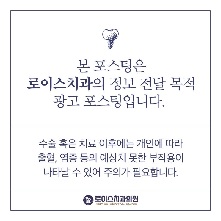  전체임플란트 장점과 절차, 로이스치과에서 알려드립니다.