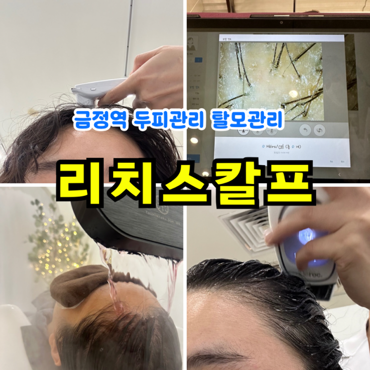  [안양두피관리] 리치스칼프: 임신 출산 탈모관리 산본 두피관리 금정역미용실