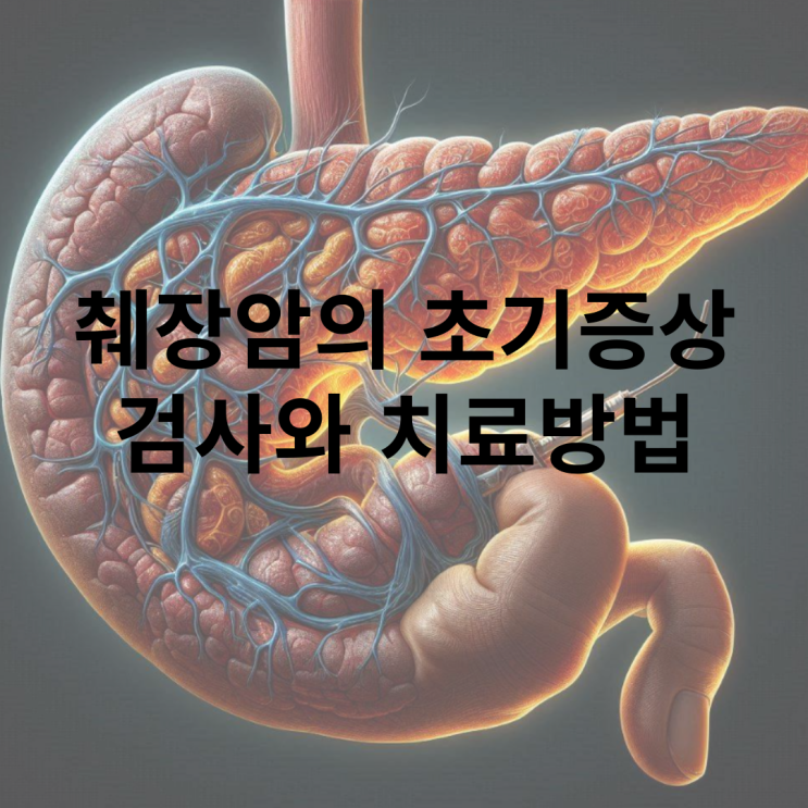  췌장암 초기 증상으로 인한 검사 방법은?