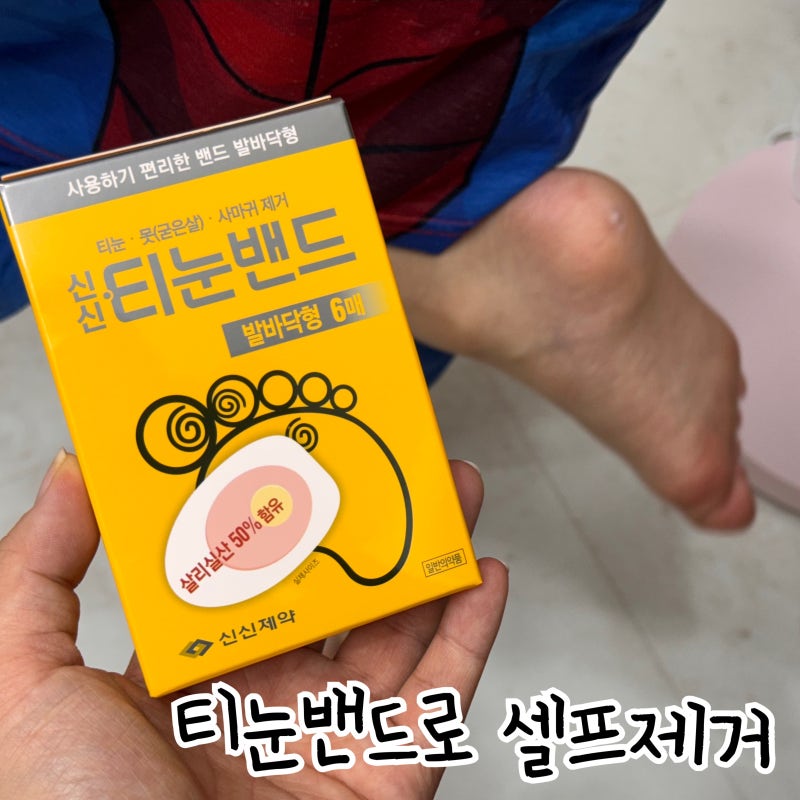 6살아기 발바닥 티눈제거, 티눈밴드로 셀프제거