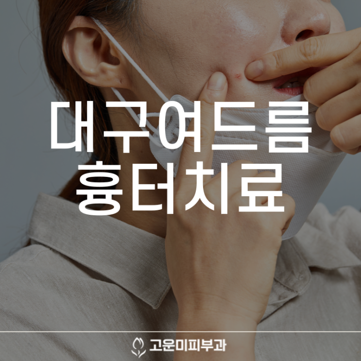  대구여드름흉터치료 다양한 패턴별로 나타나는 여드름 흉터 고운미 피부과에서 제안하는 치료 노하우