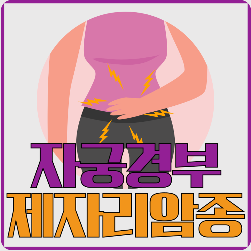 자궁경부의 제자리암종 초기 증상 알아두세요