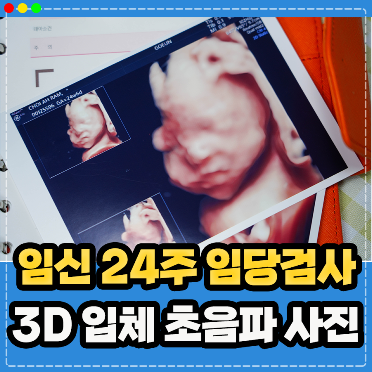  임신 24주 태아 3D 입체 초음파 사진 및 임산부 당뇨검사 임당검사