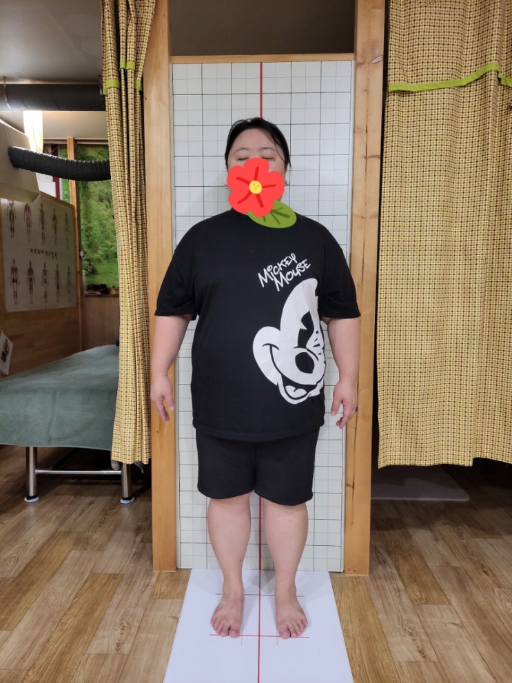  시흥자세교정 시흥통증관리 바른몸자세교정원
