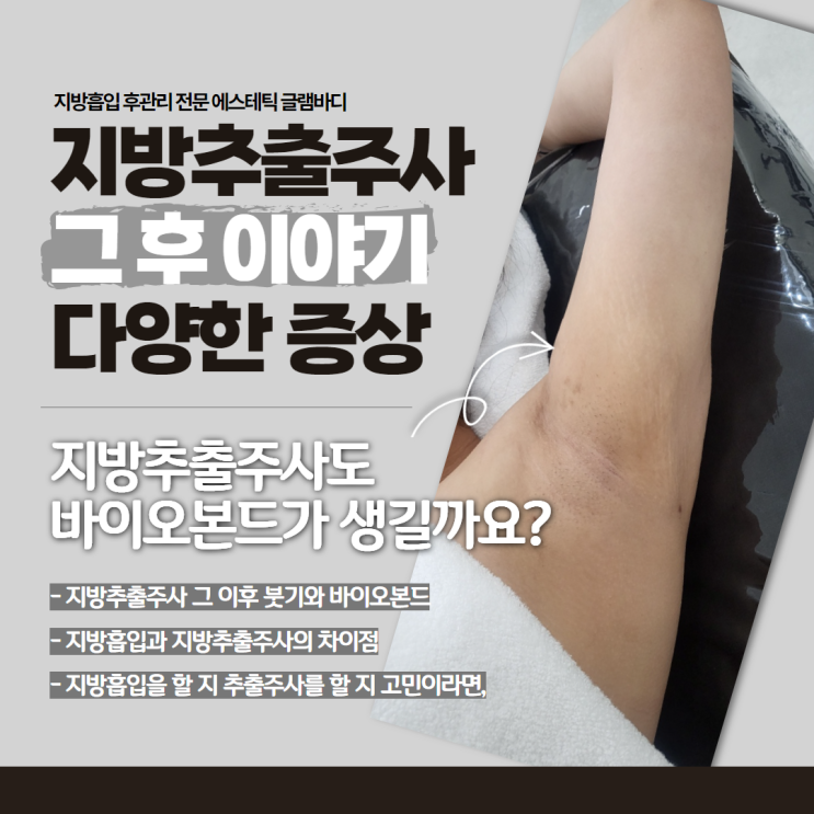  지방흡입과 람스의 차이점은?