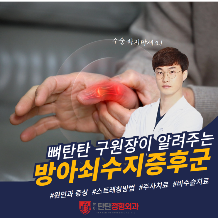  대구 방아쇠수지증후군 원인과 치료 스트레칭 방법<정형외과 전문의 작성>