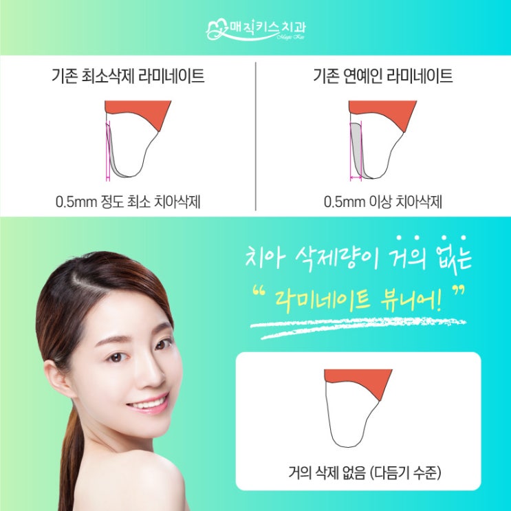  무삭제 라미네이트로 간편하게 환한 미소! – 매직키스치과 정유미 원장님