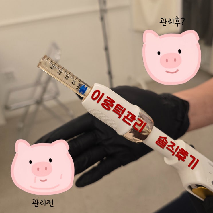  대전 가수원동 이중턱관리 두턱 남자 1회차 후기 (루모어부티끄 라인젯)