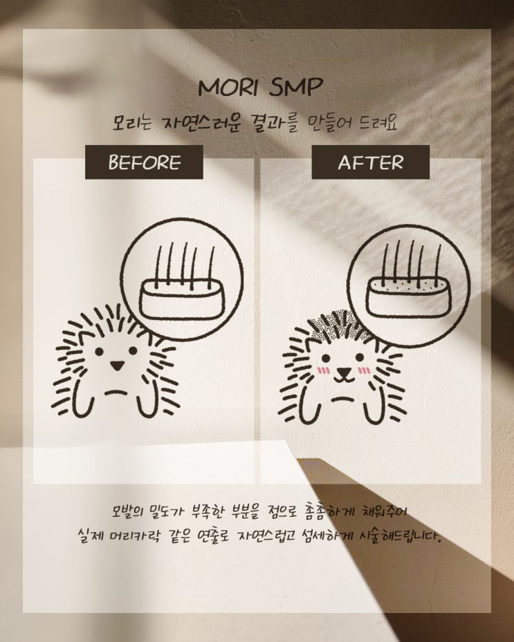 인천 청라투피문신 탈모커버 주의사항은 없을까?
