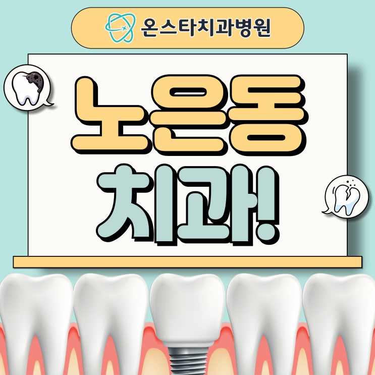  노은동 치과 자체 기공실로 임플란트 치료 기간 단축