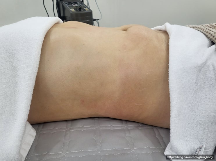  바이오본드 관리에 도움이 되는 방법은?