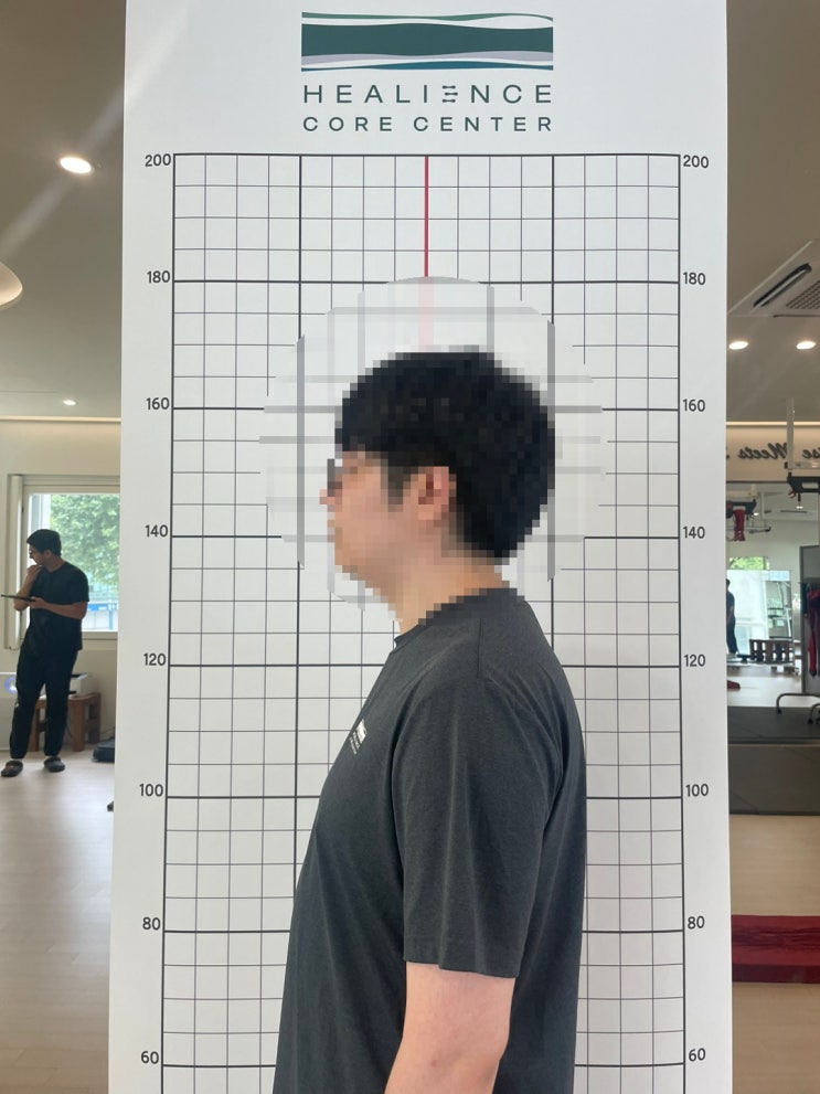  [강남 삼성동PT피티]거북목 집중 개선 Before & After