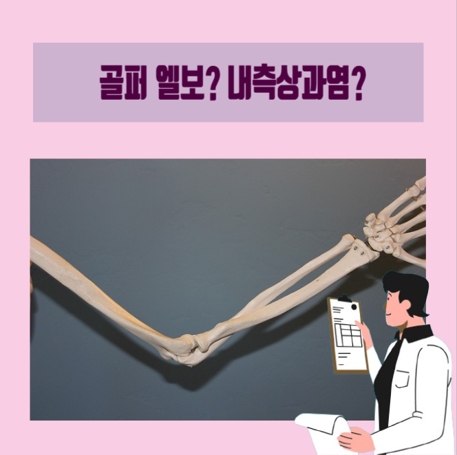  [이학박사] 팔꿈치 안쪽 통증! 내측상과염의 원인, 증상, 치료
