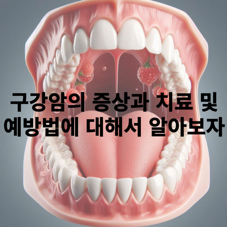  구강암 초기 및 전조증상에 대해 알아보자