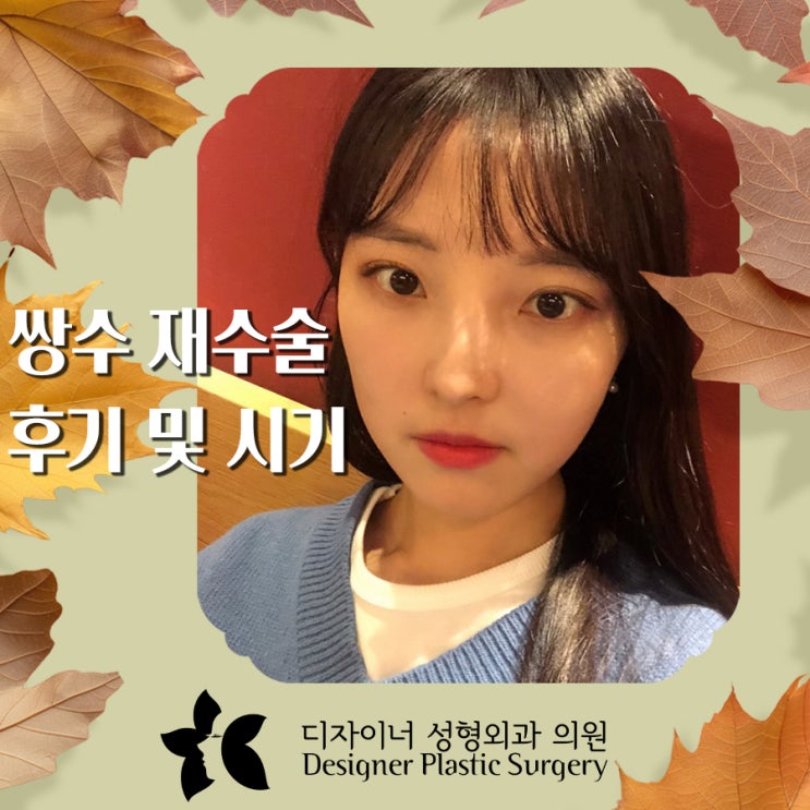  쌍수 재수술 후기 및 시기를 확인하며 원하는 눈매로 돌아가기