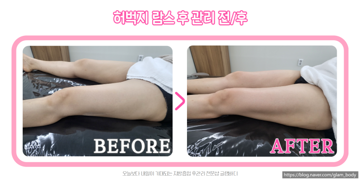 람스 바이오본드 후관리가 고민이라면?