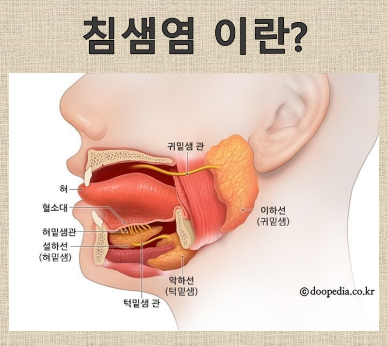 침샘염에대해서: 증상,원인, 치료법까지.