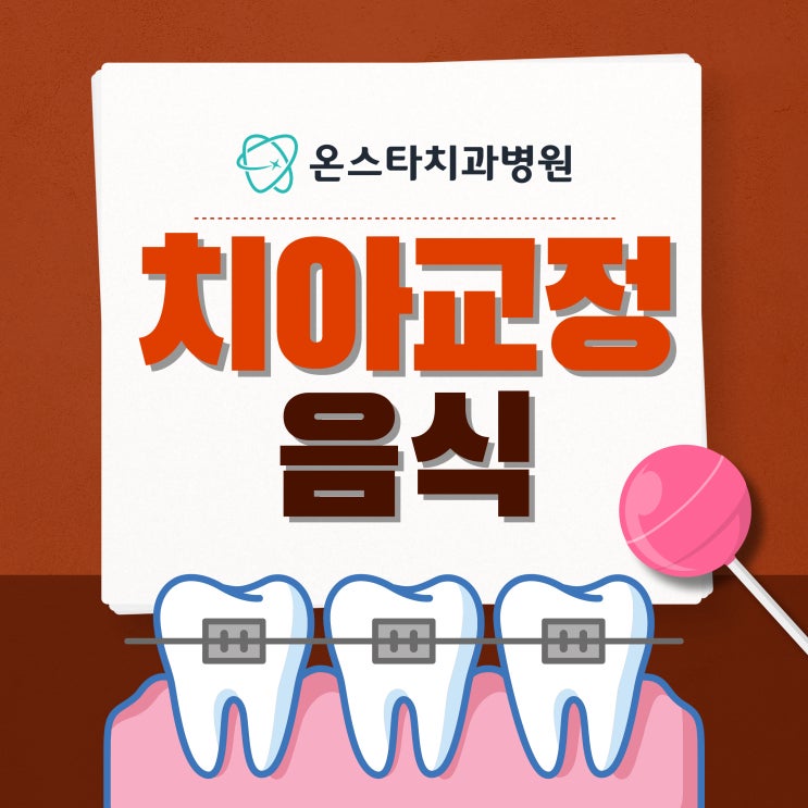  치아교정 중 음식 어떻게 먹어야 할까?
