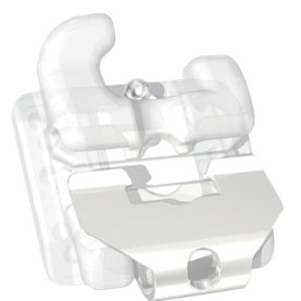  자가결찰 브라켓 vs 비자가결찰 브라켓 (수동 브라켓) 차이가 뭘까요? "self-ligating bracket"