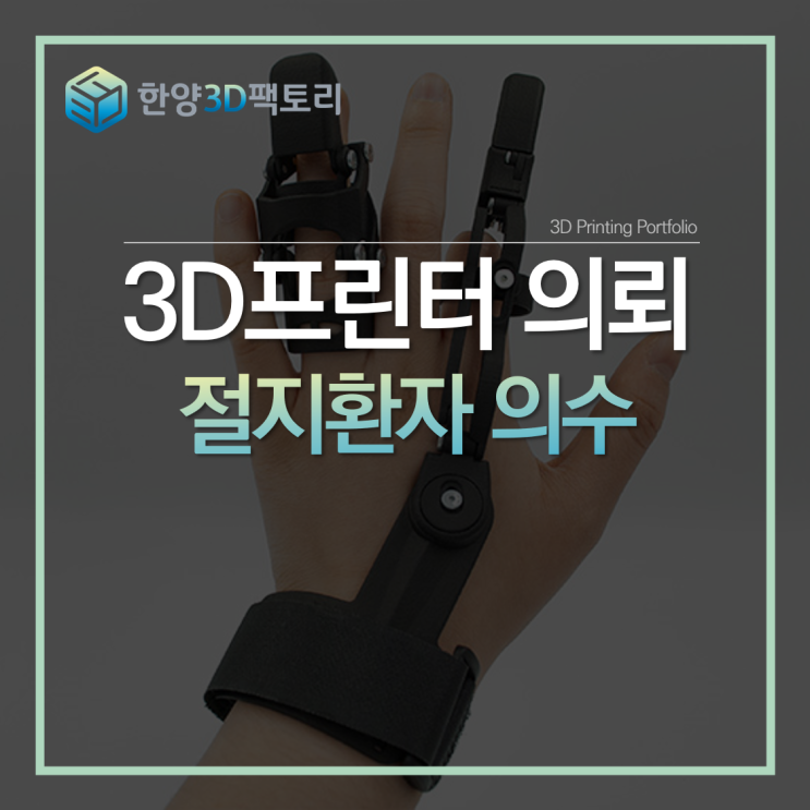  1대1 개인 맞춤 설계된, 절지환자 의수