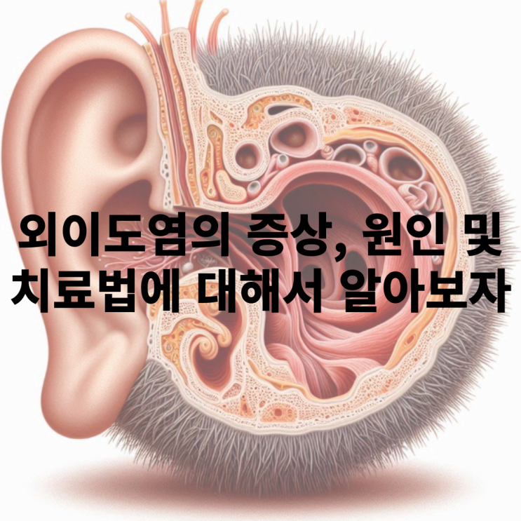  외이도염 증상은 무엇인가?