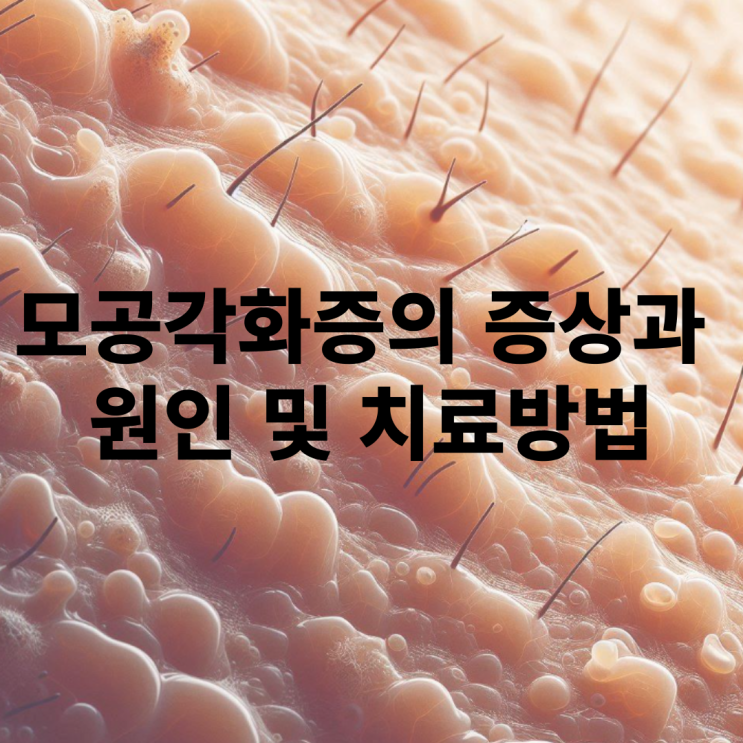  모공각화증 피부과 치료방법은?