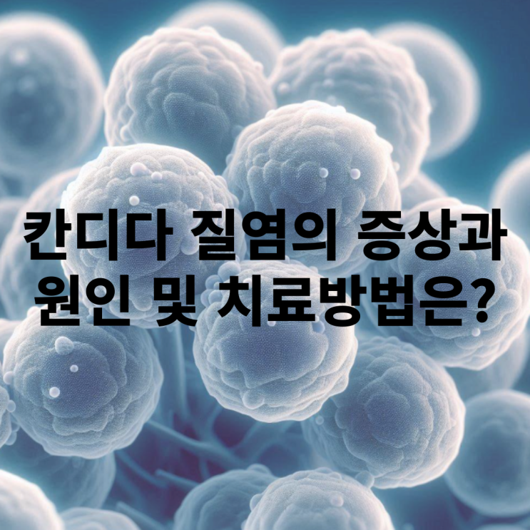  칸디다질염 원인과 증상에 대해 알아보자!