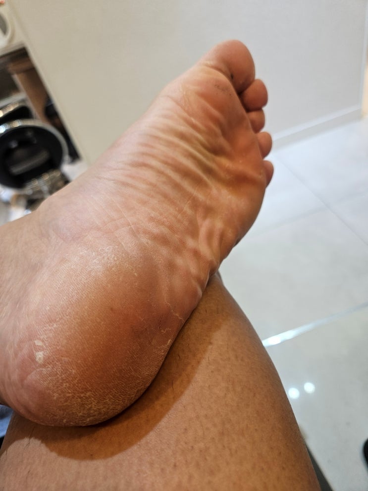  부산동래 발각질 관리 난생처음 받아 새발이 된 느낌
