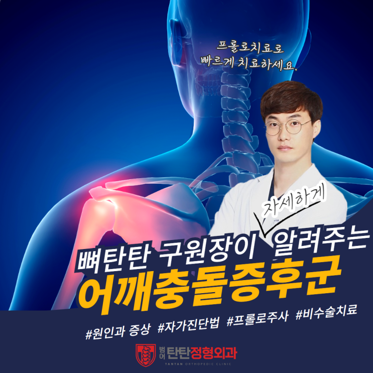  어깨충돌증후군, 프롤로주사로 극복 가능할까?<전문의 작성>