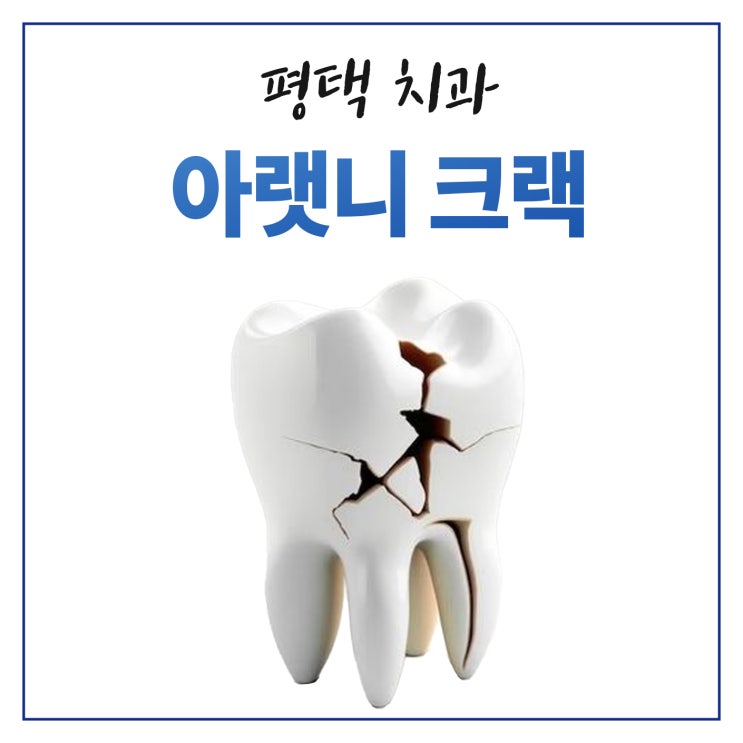  평택 아랫니 충치 크랙 레진 치과 치료 사례