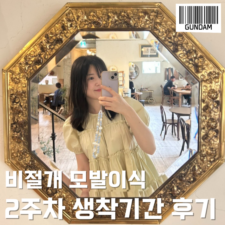  헤어라인 모발이식 생착기간 2주 경과 및 후유증 등